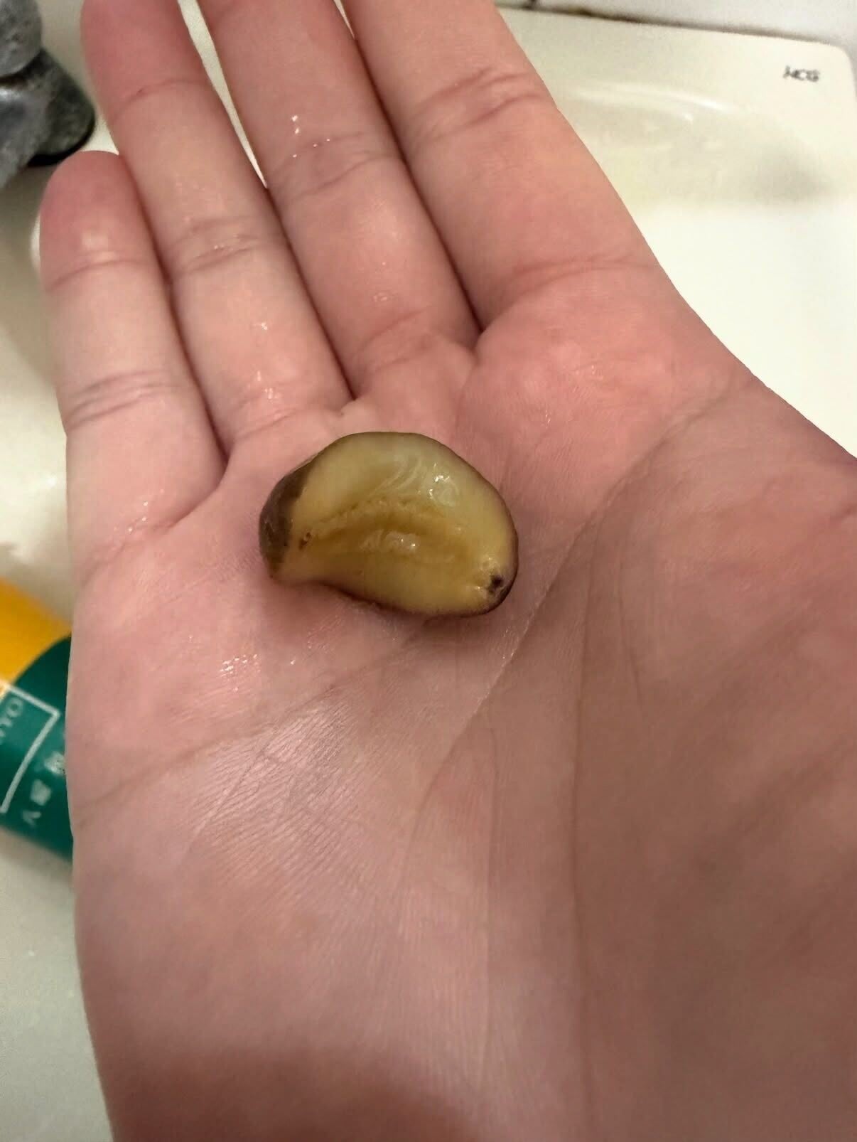 台男飲手搖驚現 誤食蛞蝓原來好大鑊!或感染廣東住血線蟲