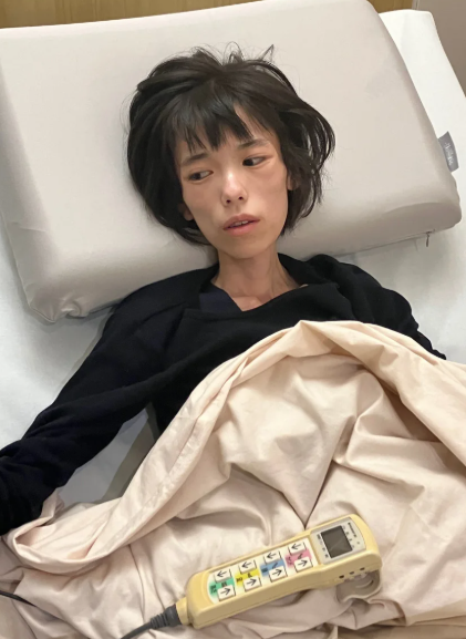 流奈獲釋後罹患嚴重PTSD與厭食症。(互聯網)