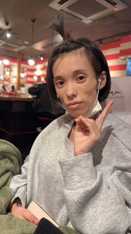 流奈獲釋後罹患嚴重PTSD與厭食症。(互聯網)