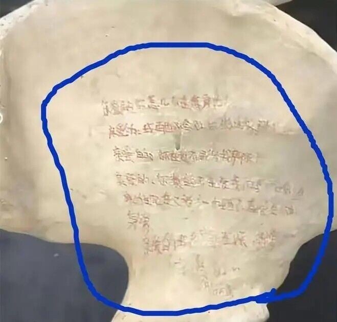 有疑似醫科生的網友日前拍下骨骼標本上的輕挑留言