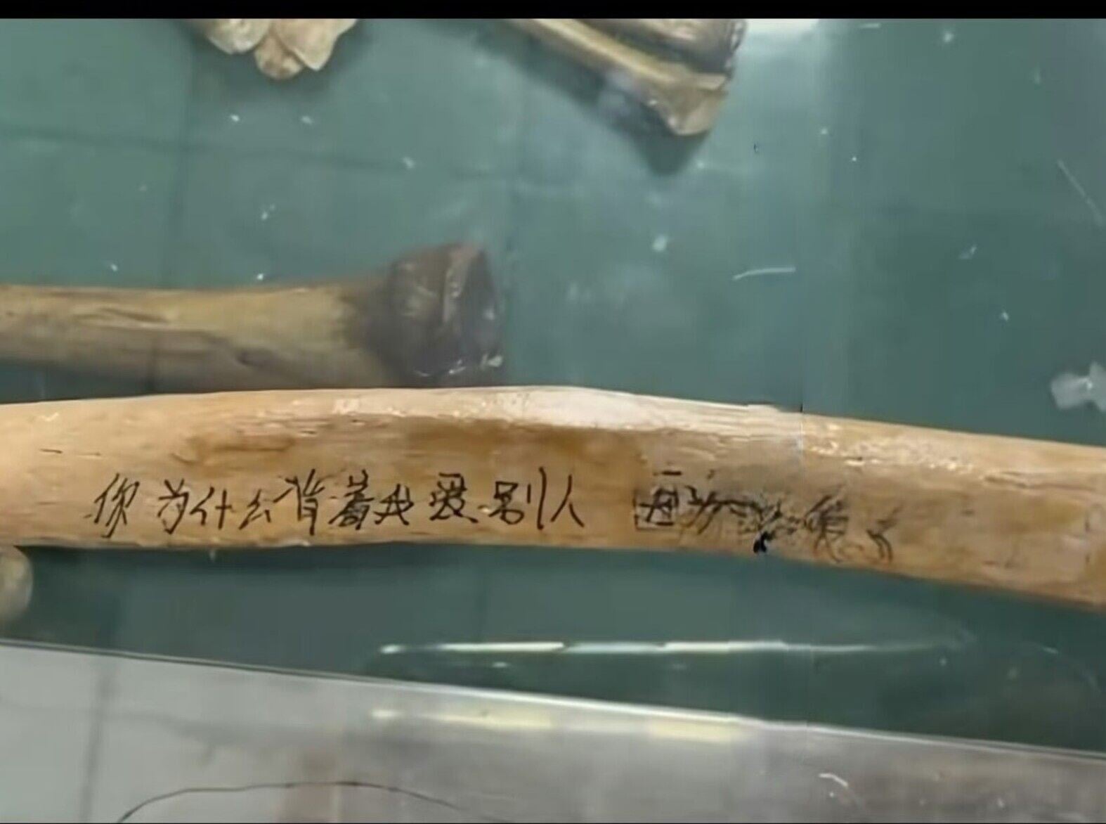 醫科生疑在骨頭上寫上「你為甚麼背著我愛別人」