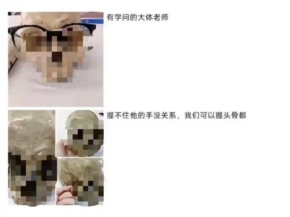 湖南長沙曾有新生將遺體捐獻者頭骨戴上眼鏡