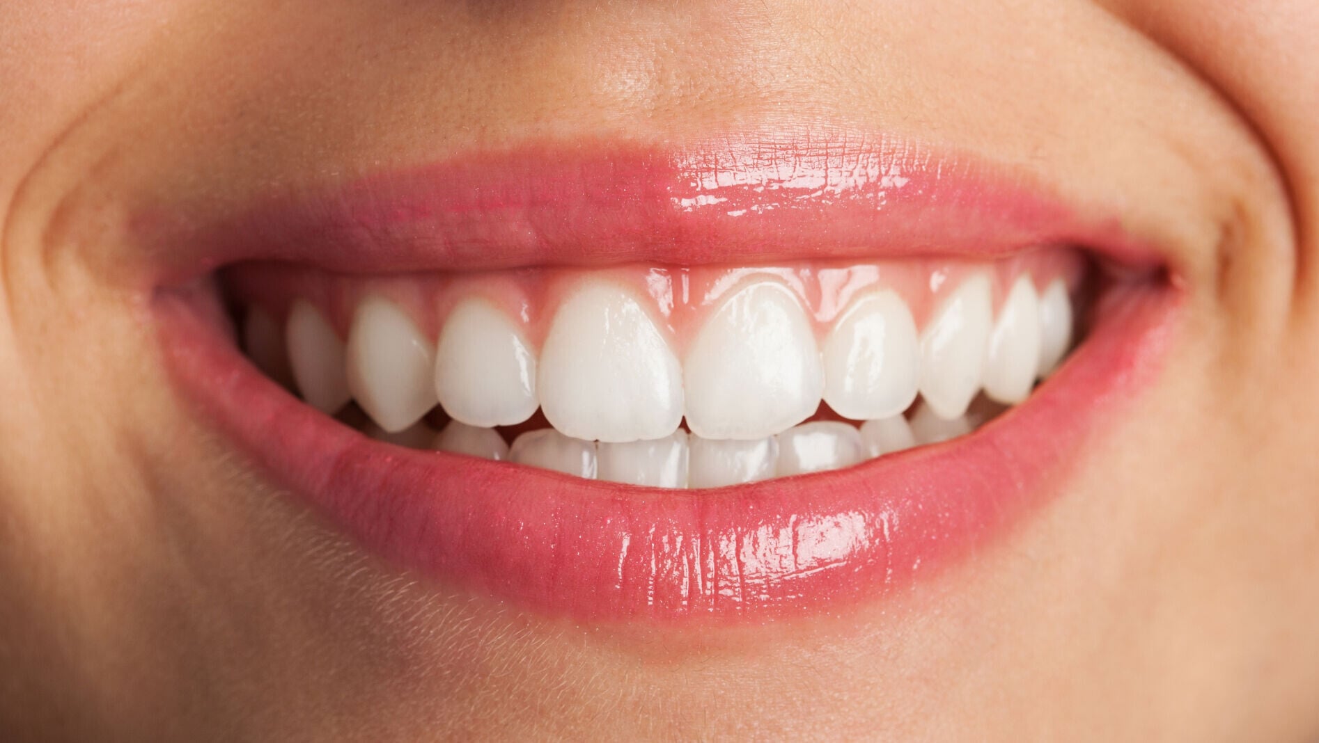 Close up perfect smile