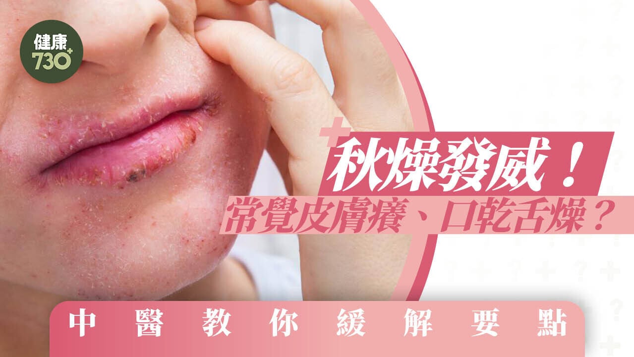 秋燥症狀｜皮膚癢、口乾舌燥 中醫教百合枸杞菊花茶等緩解食療