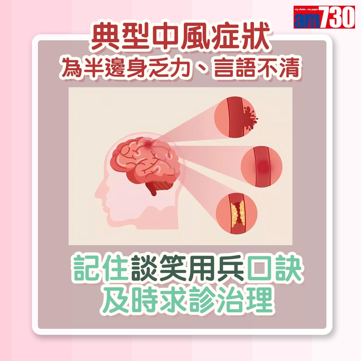 典型中風症狀為半邊身乏力,言語不清,為及時求診治理,不妨記住「談笑用兵」口訣