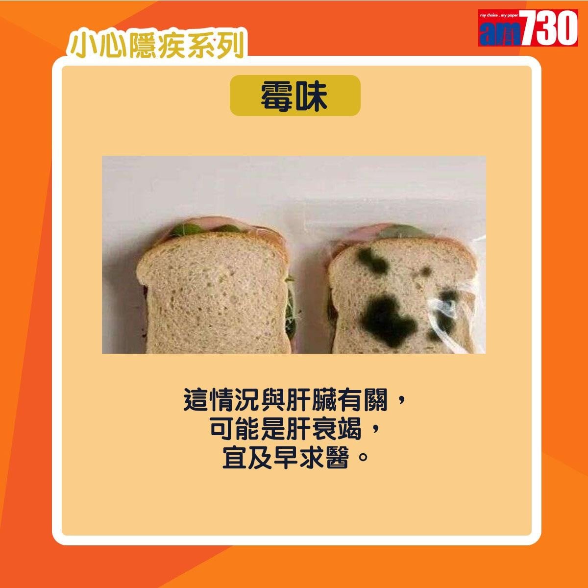 小便|尿味異常或因糖尿病或腎衰竭等疾病(am730製圖)