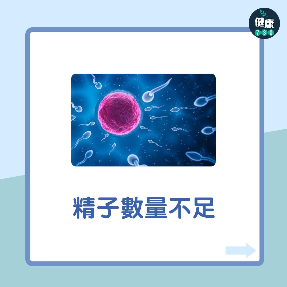 男性不育7大原因︰精子數量不足(am730製圖)