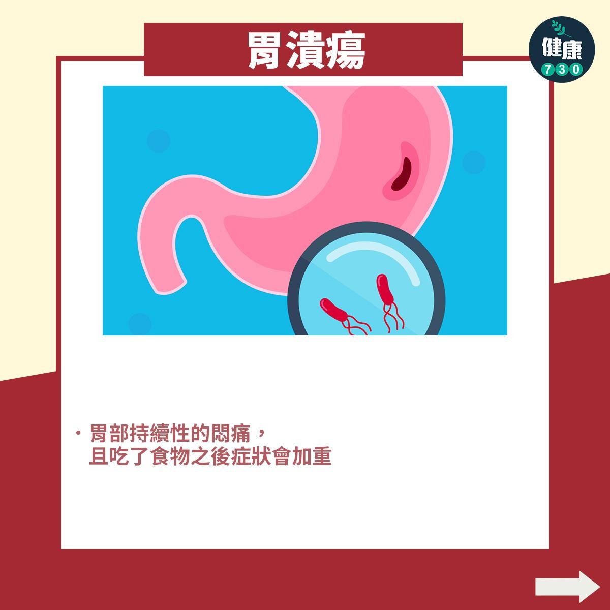 胃痛|胃炎、胃潰瘍、胃酸倒流分別(am730製圖)