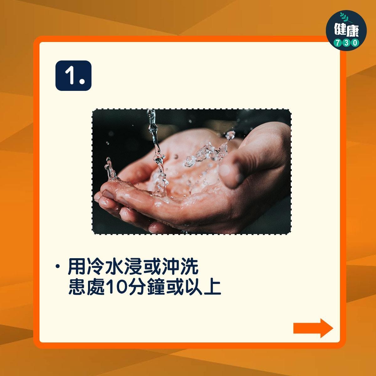 燙傷處理方法(am730製圖)