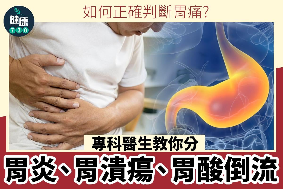 胃痛|胃炎、胃潰瘍、胃酸倒流症候分別?專科醫生教你(am730製圖)