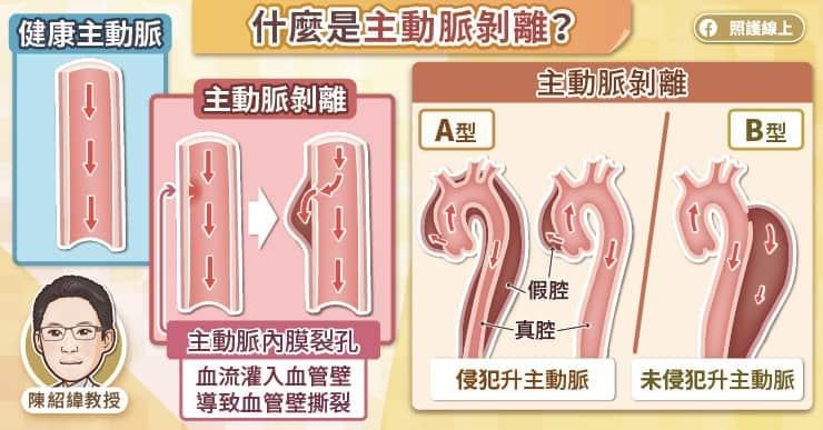 主動脈剝離或會危及性命 醫師詳細解說A、B型治療方法 | am730