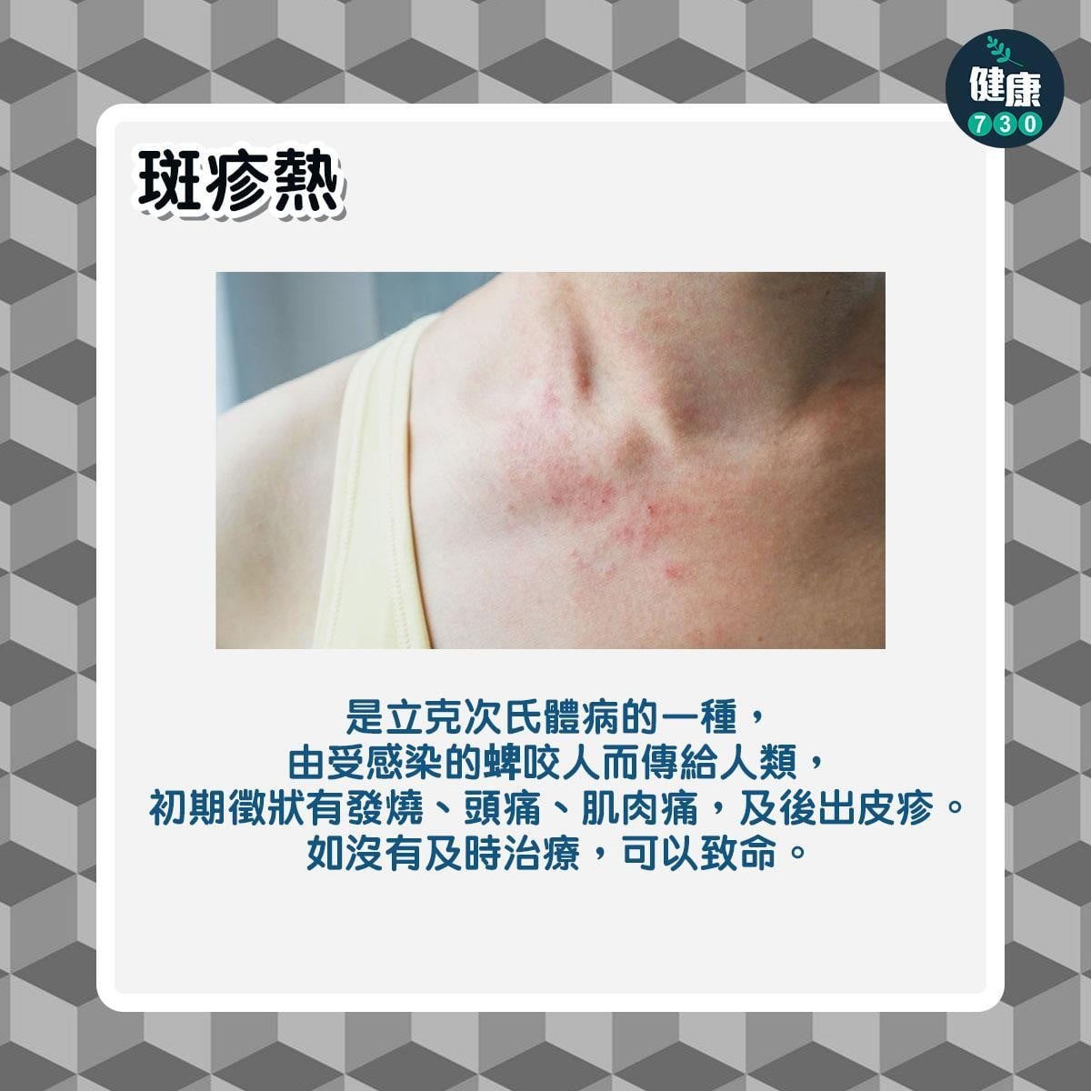 鼠患|6大常見老鼠傳染病,包括鼠疫及鼠斑疹傷寒(am730製圖)