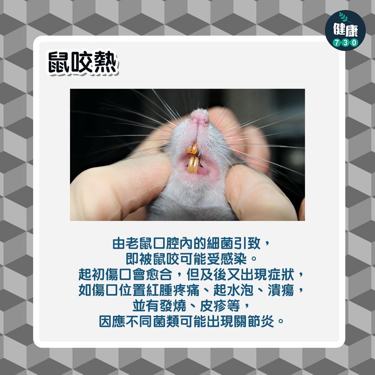 鼠患|6大常見老鼠傳染病,包括鼠疫及鼠斑疹傷寒(am730製圖)