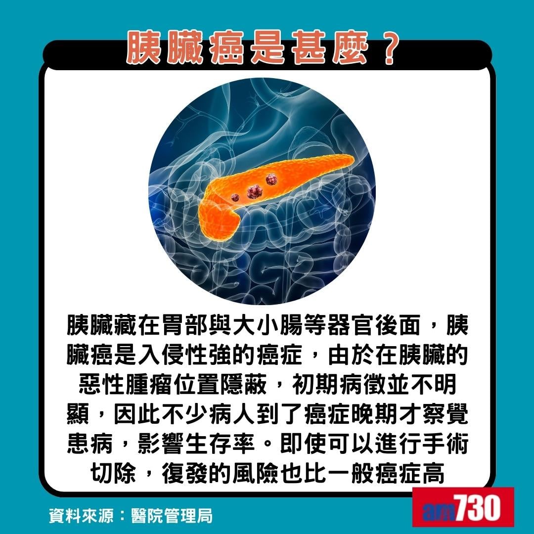 胰臟癌點解叫癌王|胰臟癌是甚麼?(am730製圖)