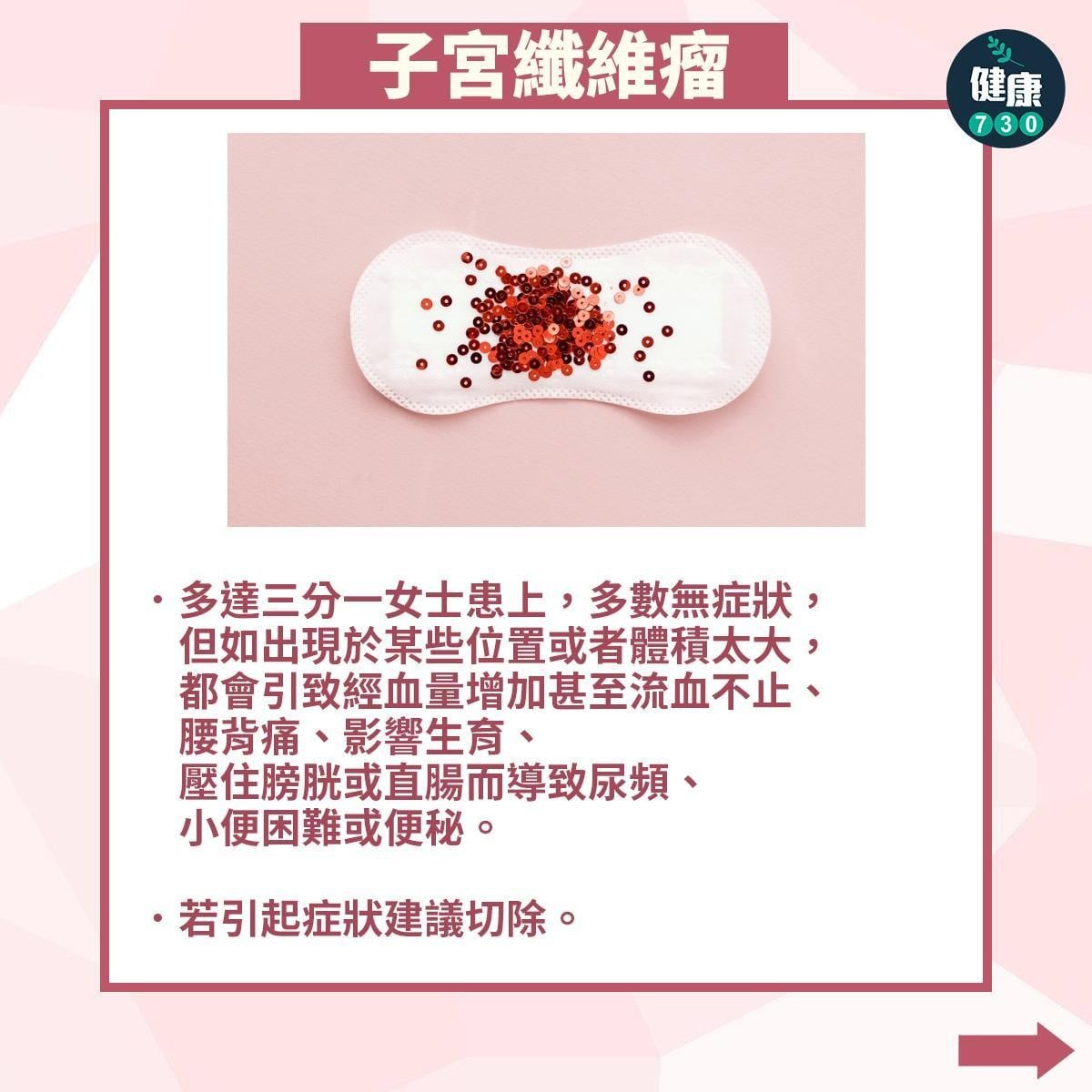 常見婦科疾病|子宮纖維瘤(am730製圖)