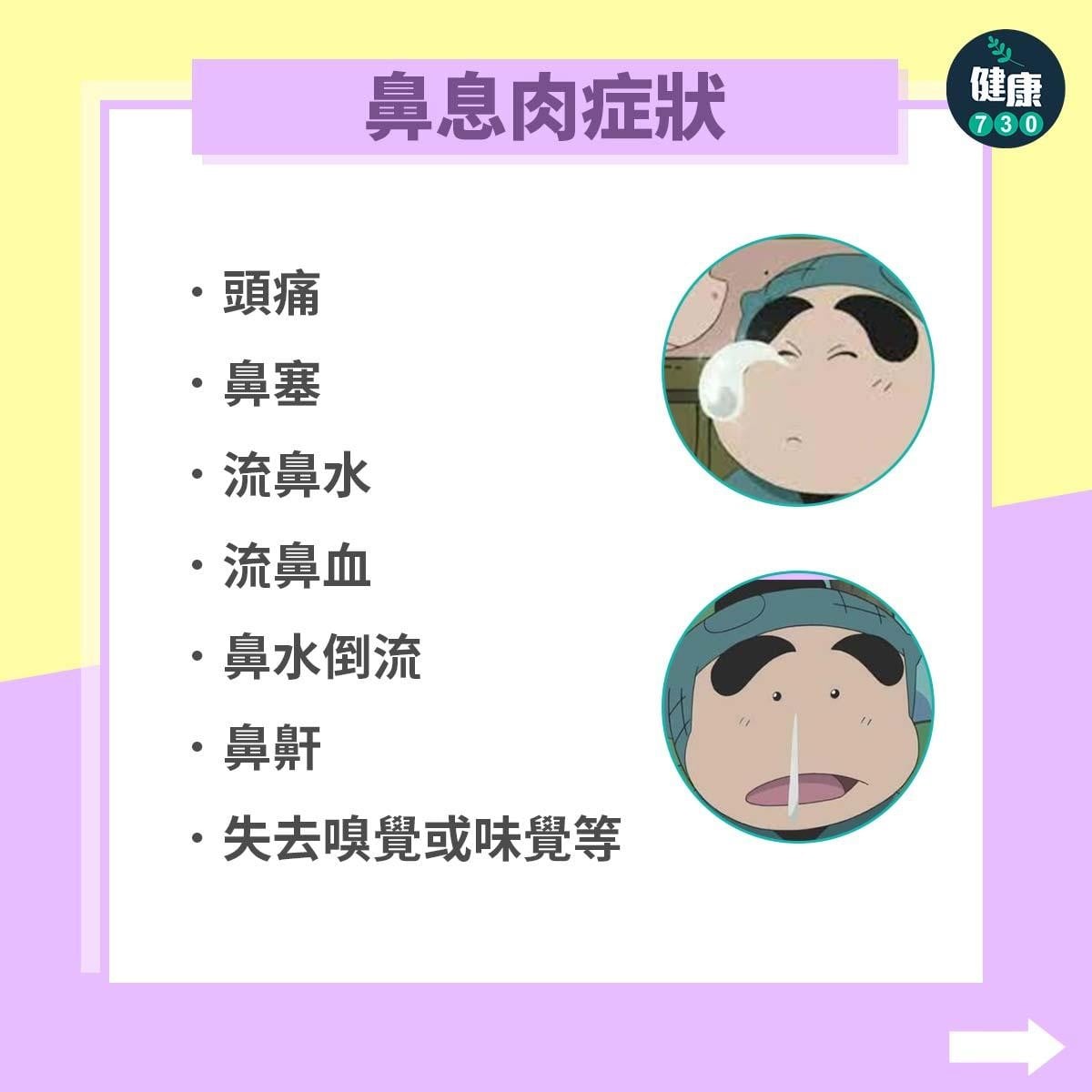 鼻敏感可致鼻息肉，鼻息肉症狀包括頭痛、鼻水倒流及鼻鼾等。（am730製圖）