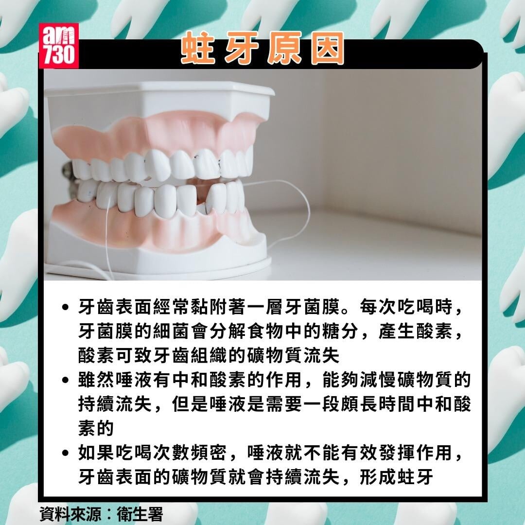 蛀牙點算?原因(am730製圖)