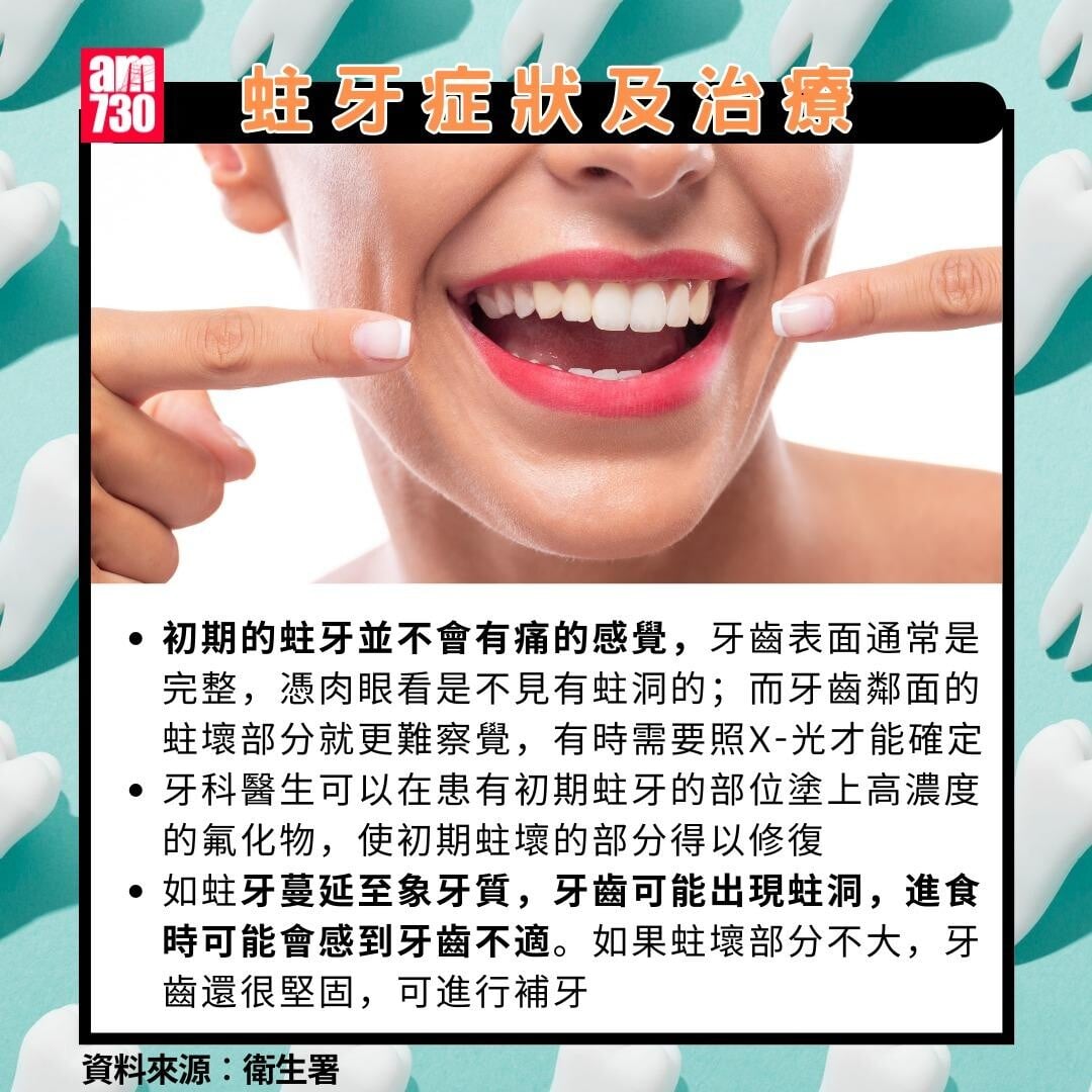 蛀牙點算?症狀及治療(am730製圖)
