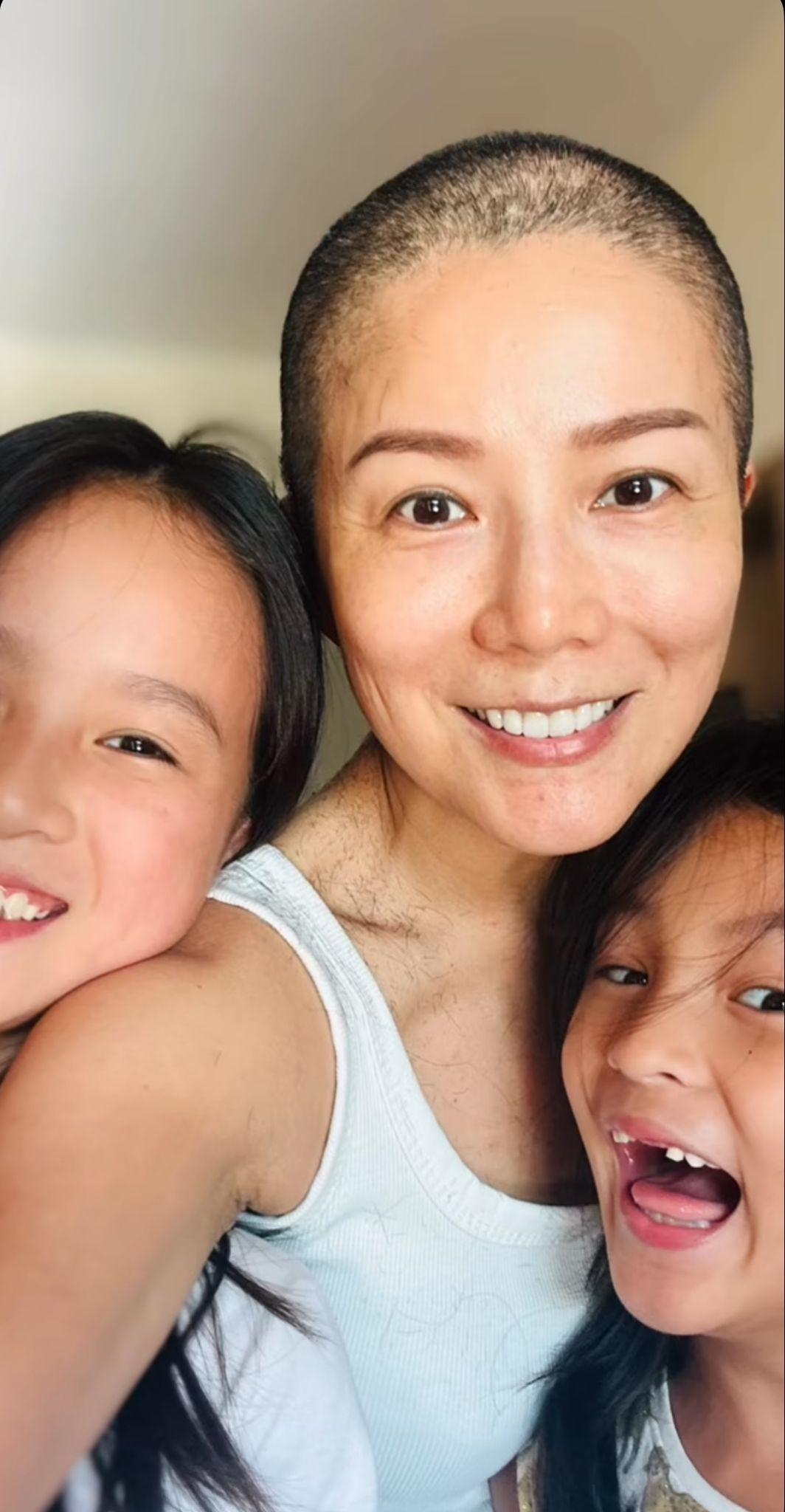 吳文忻化療後狂脫髮, 兩女兒親自操刀剃光頭。
