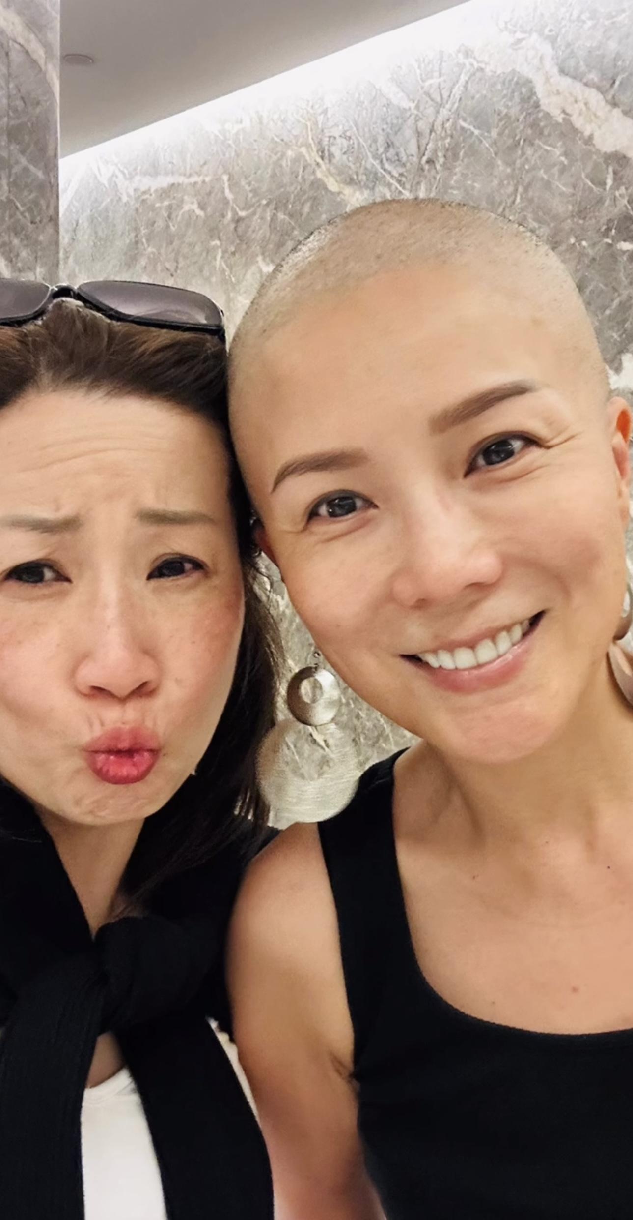 吳文忻除去頭巾,頂着光頭與朋友合照。