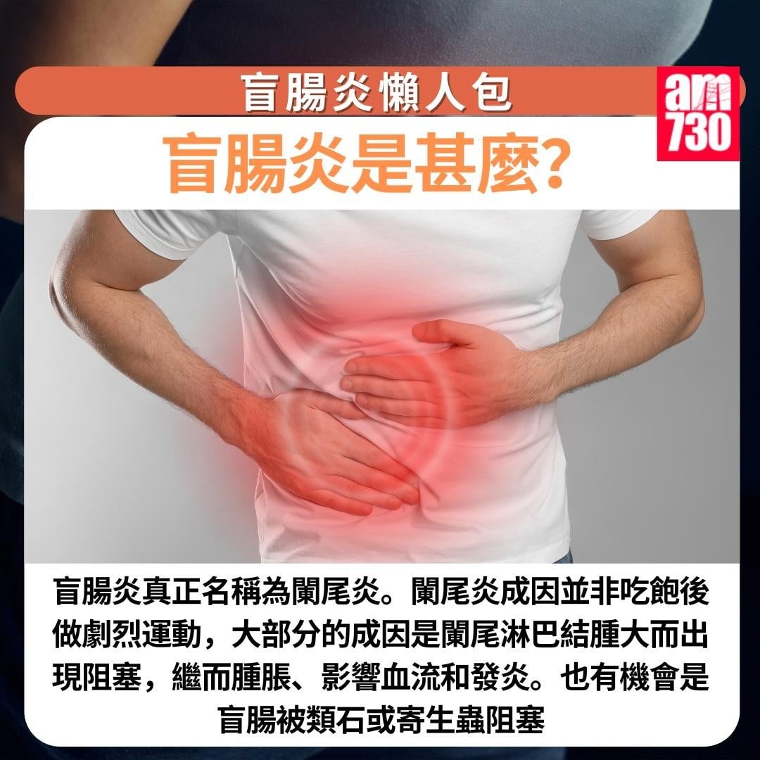 盲腸炎懶人包|盲腸炎是甚麼?(am730製圖)