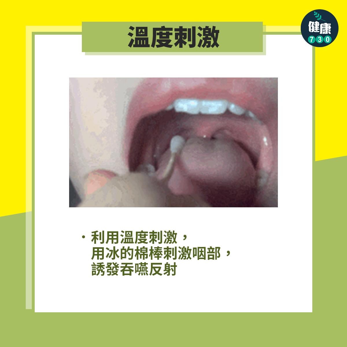 中風復健運動改善吞嚥困難|溫度刺激(am730製圖)