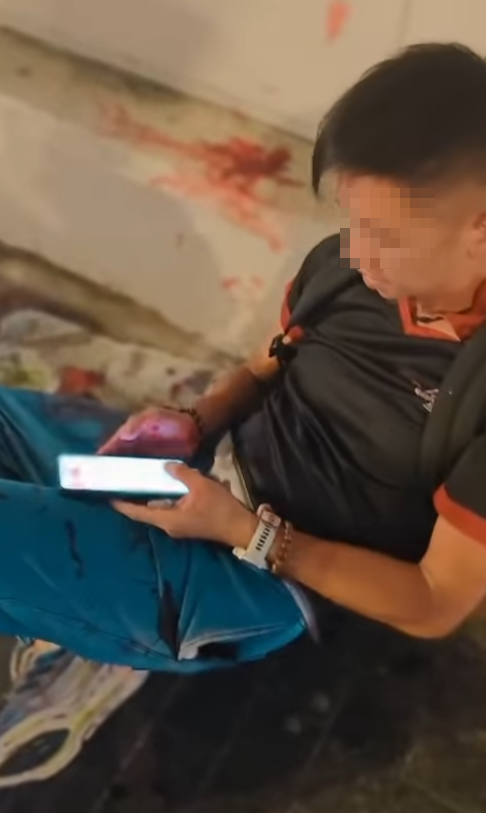 休班PTU警長彌敦道街頭遭搶銀包,與一名南亞裔持刀男子糾纏時被襲擊致手腳浴血,事後臥地打電話求助(影片截圖)