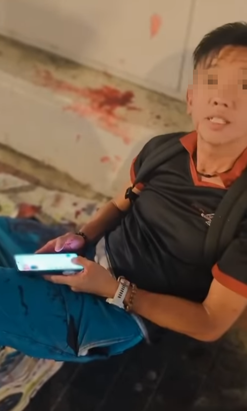 休班PTU警長彌敦道街頭遭搶銀包,與一名南亞裔持刀男子糾纏時被襲擊致手腳浴血,事後臥地打電話求助(影片截圖)