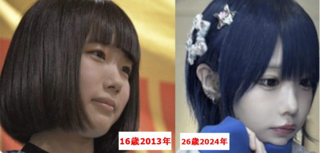 網上一直流傳ano曾經整容。