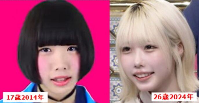 ano入行逾十年,一直惹來整容疑雲。