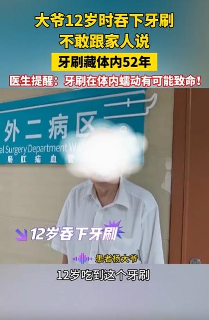 楊姓男子表示,12歲那年吞下牙刷,因害怕被父母責備,也以為會自然消化,便一直沒有理會。(互聯網)
