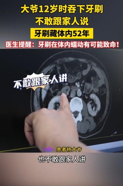 醫生替楊姓男子進行電腦掃描等檢查。(互聯網)