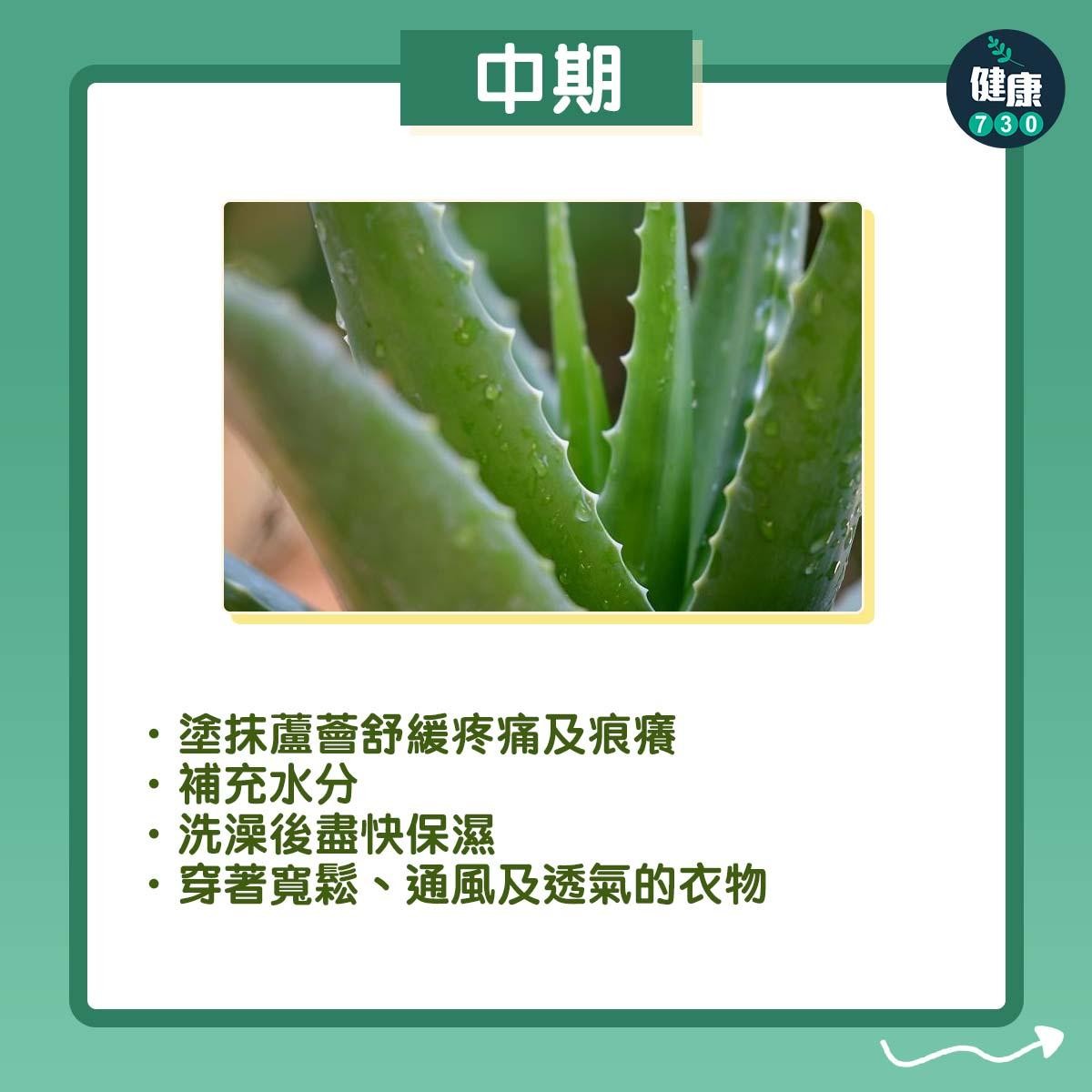 曬傷點算好?中期可塗蘆薈(am730製圖)