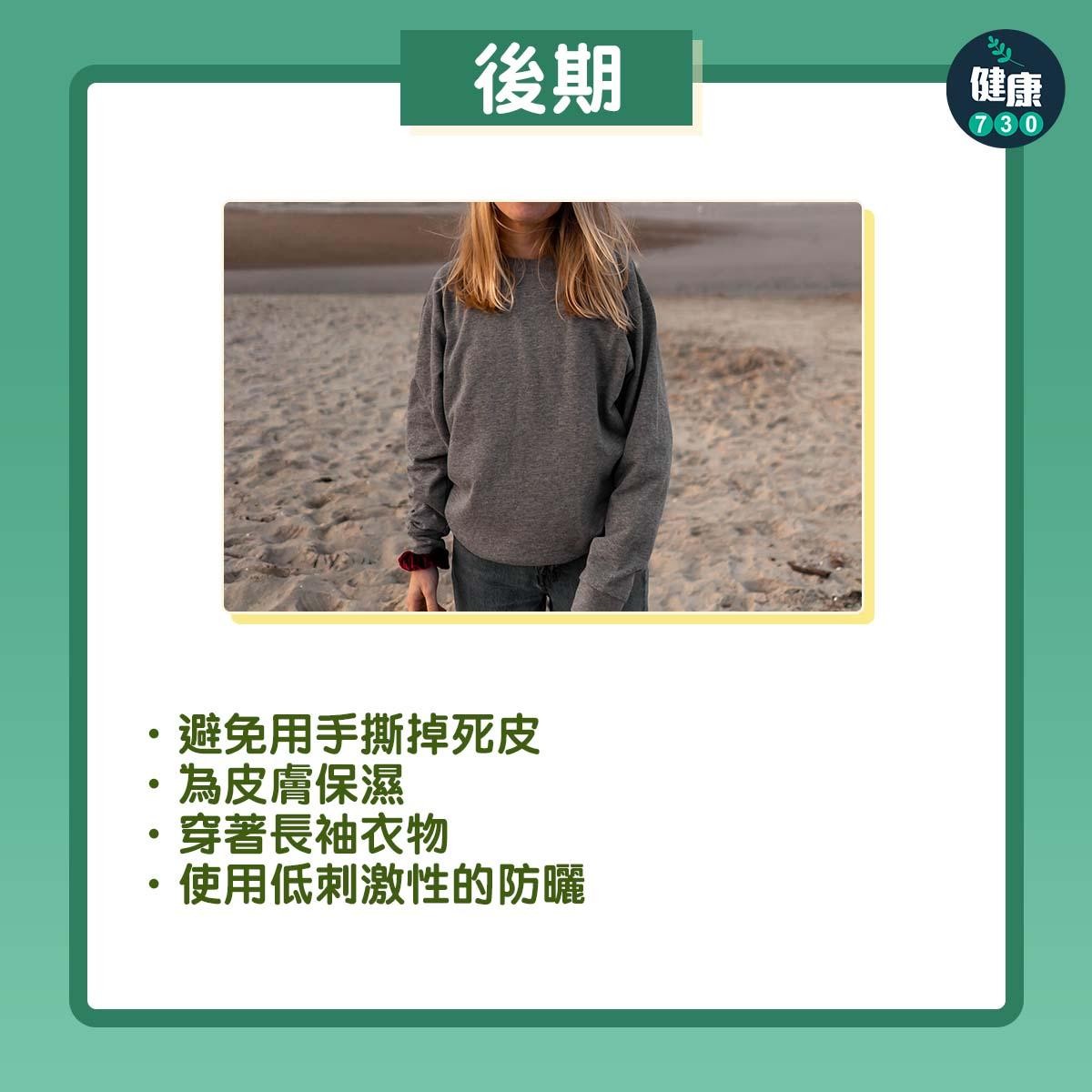 曬傷點算好?後期可避免用手撕死皮(am730製圖)
