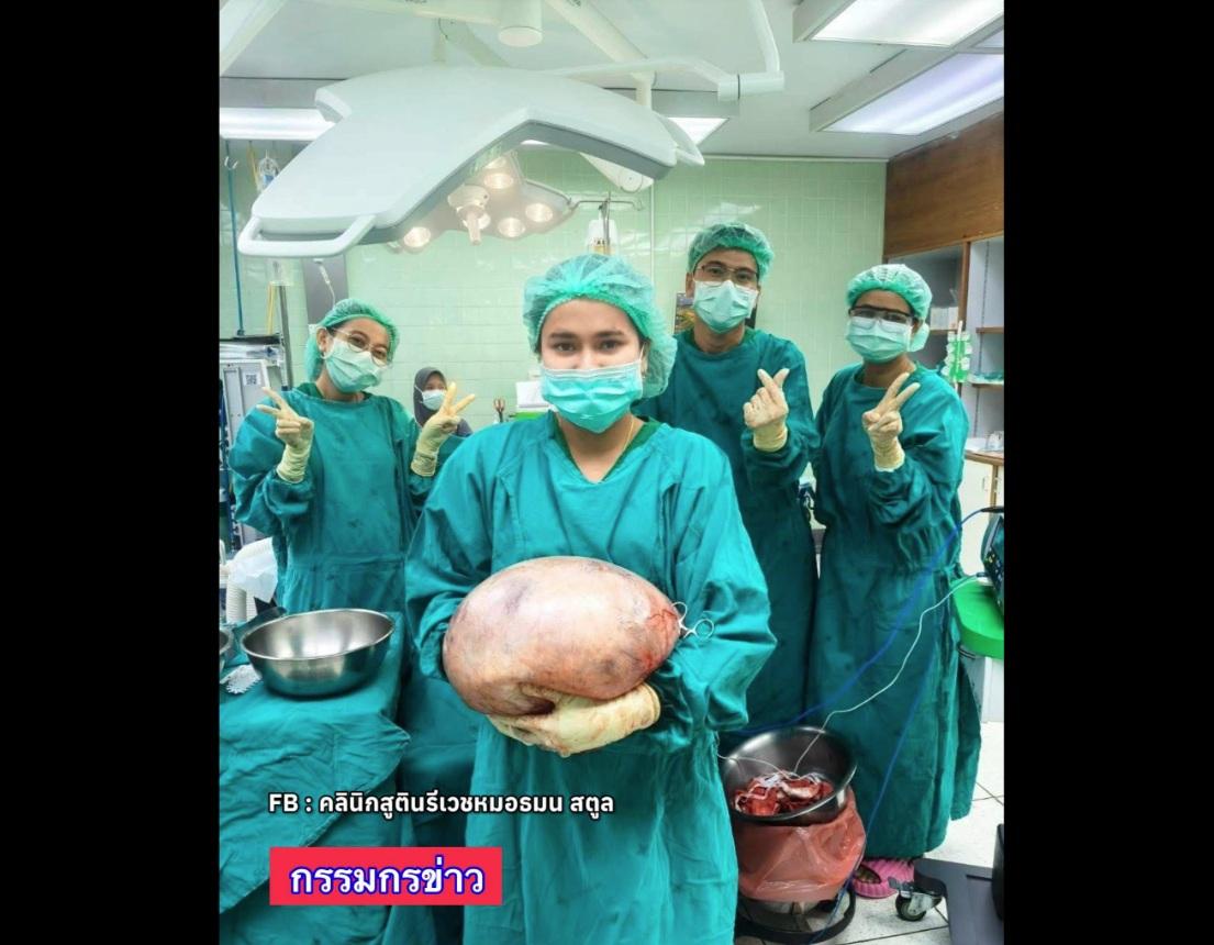 沙敦婦產科診所一名醫生在Facebook發布照片,可見醫護人員捧著巨大卵巢囊腫,其他醫護在背後展示勝利或心心手勢,看來是慶幸手術成功。(互聯網)