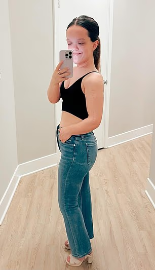 克魯斯接受肢體延長手術後。(互聯網)