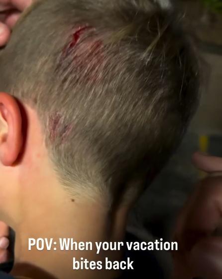 Cruise頭部流血。(IG)