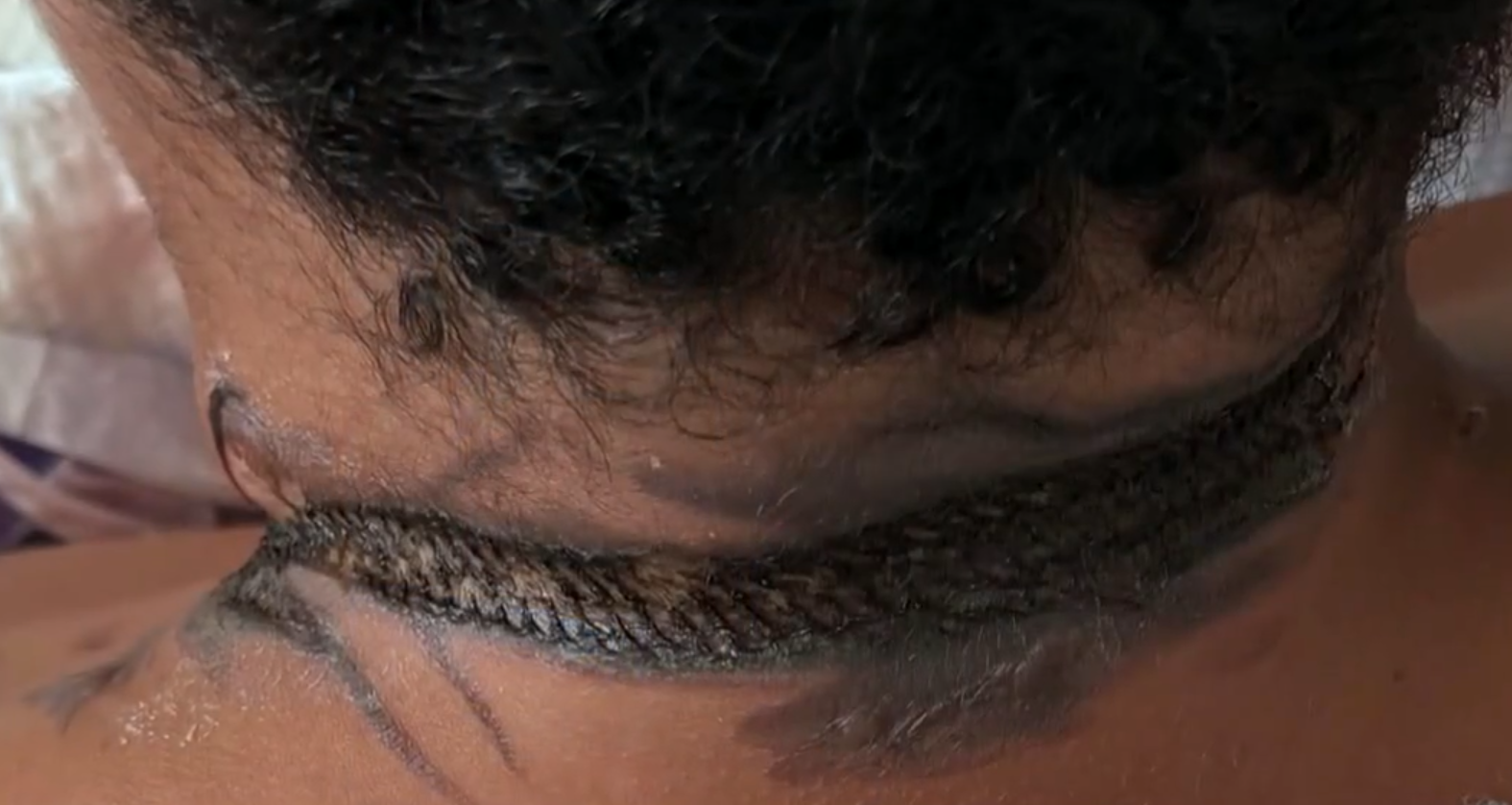 頸鍊纏住平板充電線起火 睡夢中驚醒男童頸燒燶