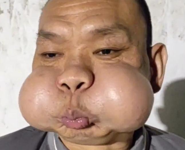 「青蛙王子」以輕鬆態度看待自身變化。