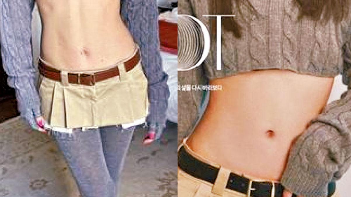 圖片新聞｜螞蟻腰 