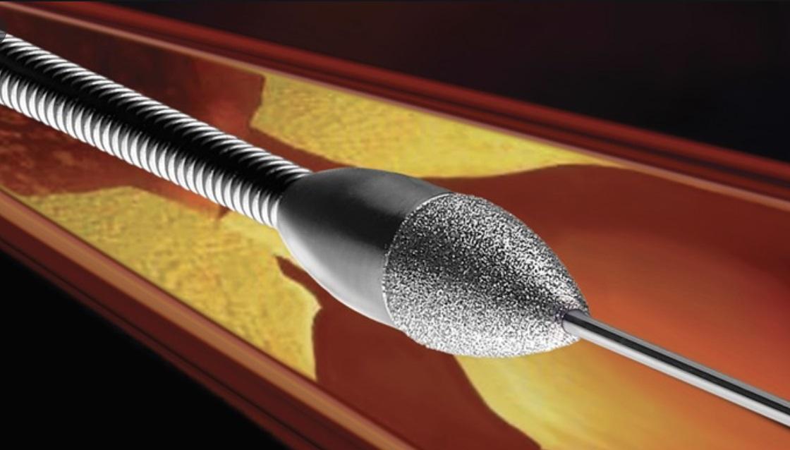 冠狀動脈斑塊旋磨術