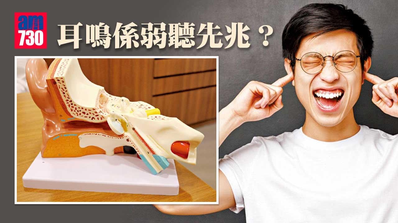 耳鳴是弱聽先兆