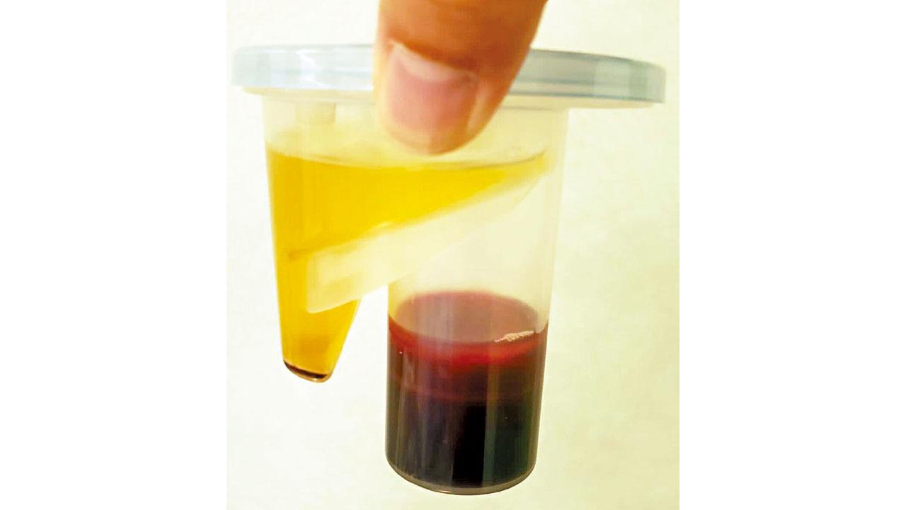 自己傷患自己救  PRP注射