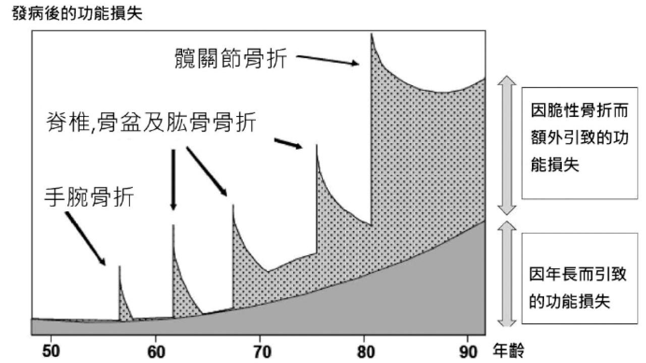 脆性骨折狂想曲