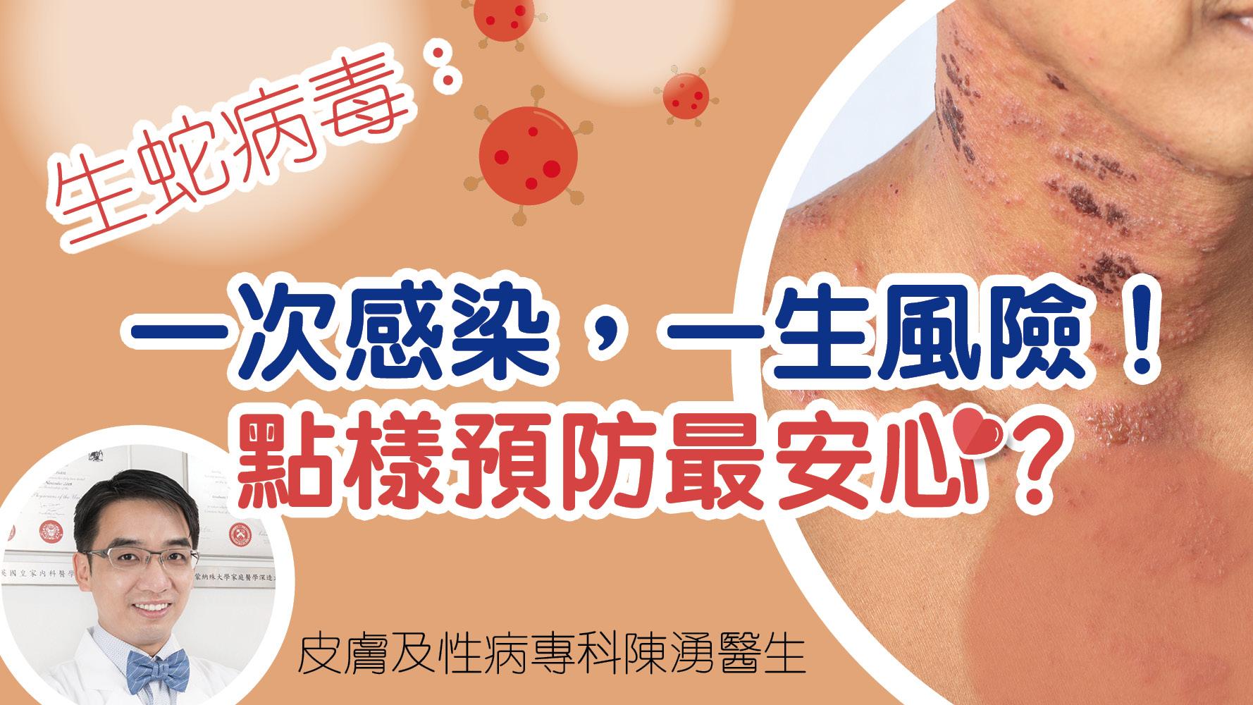 生蛇病毒：一次感染，一生風險！點樣預防最安心？
