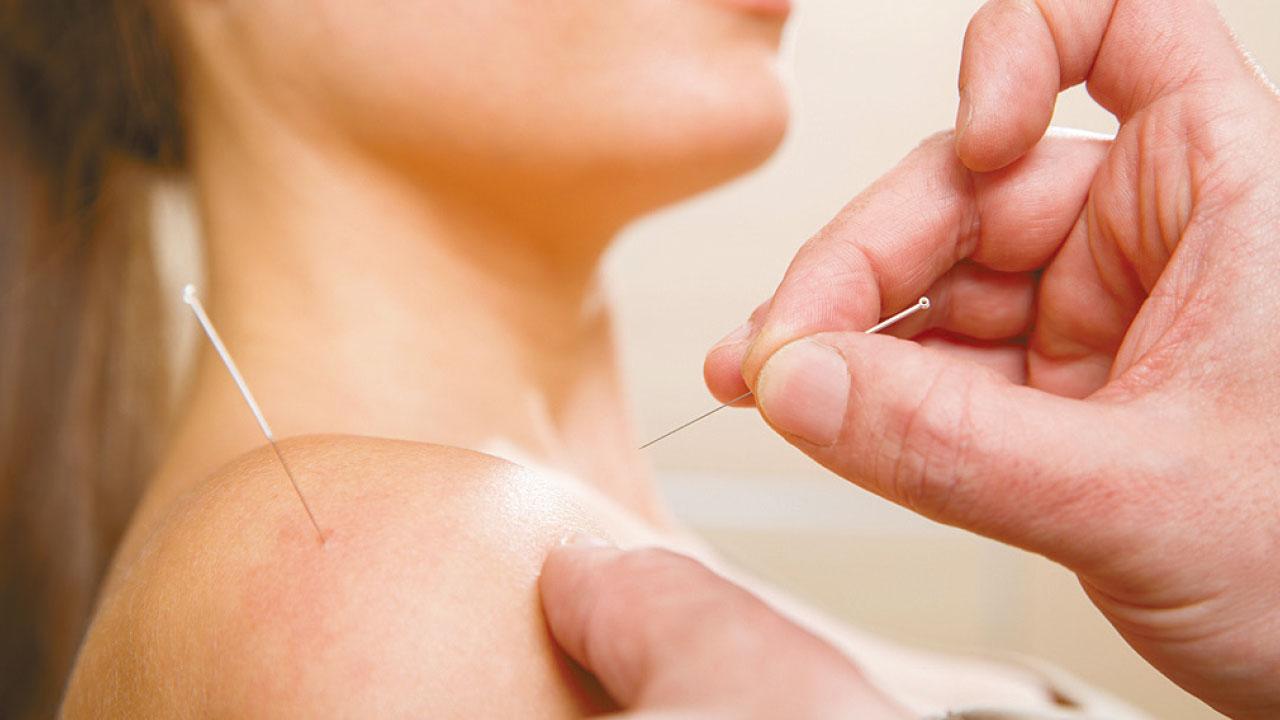 針灸推拿治療肩前痛