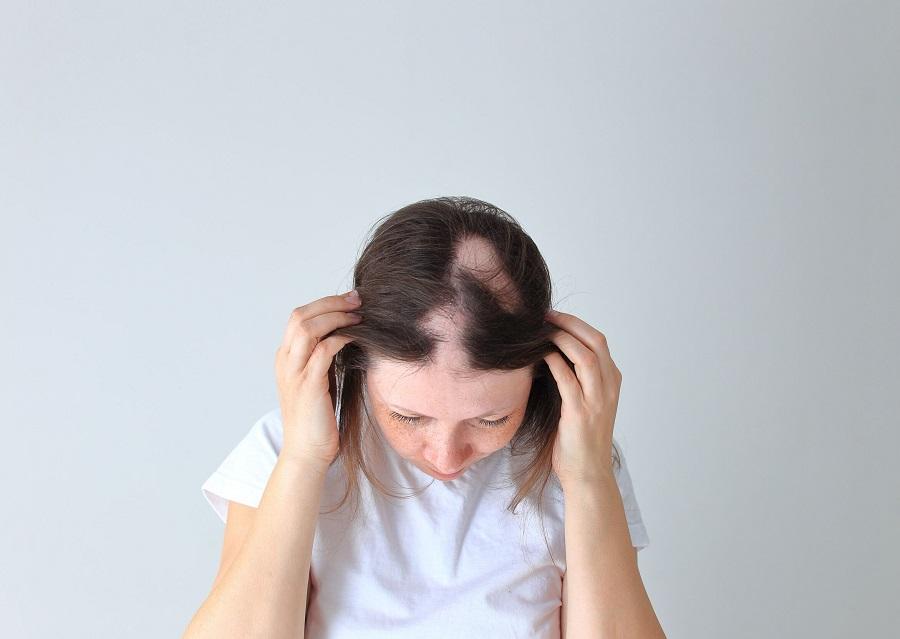 勿歧視外觀受損的人士 