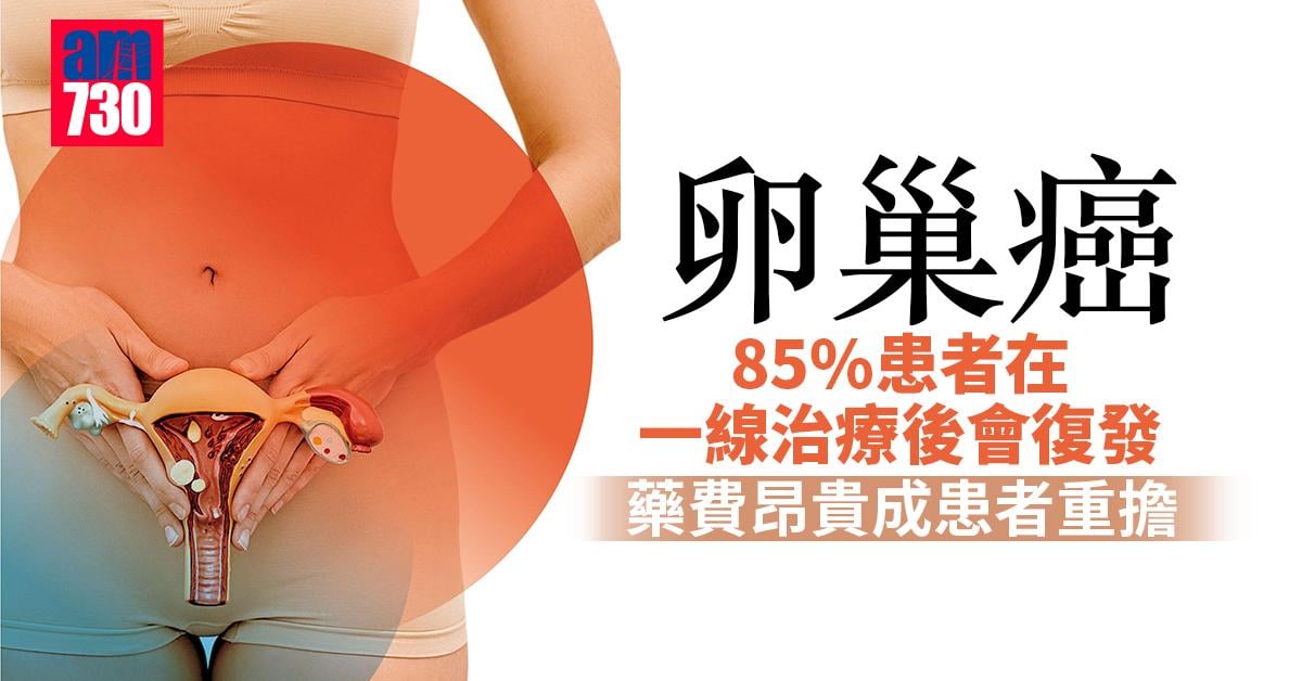 卵巢癌維持治療 成患者重擔