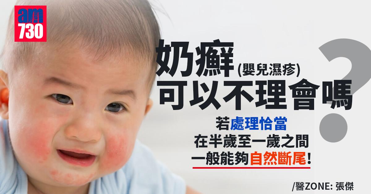 奶癬可以不理會嗎？