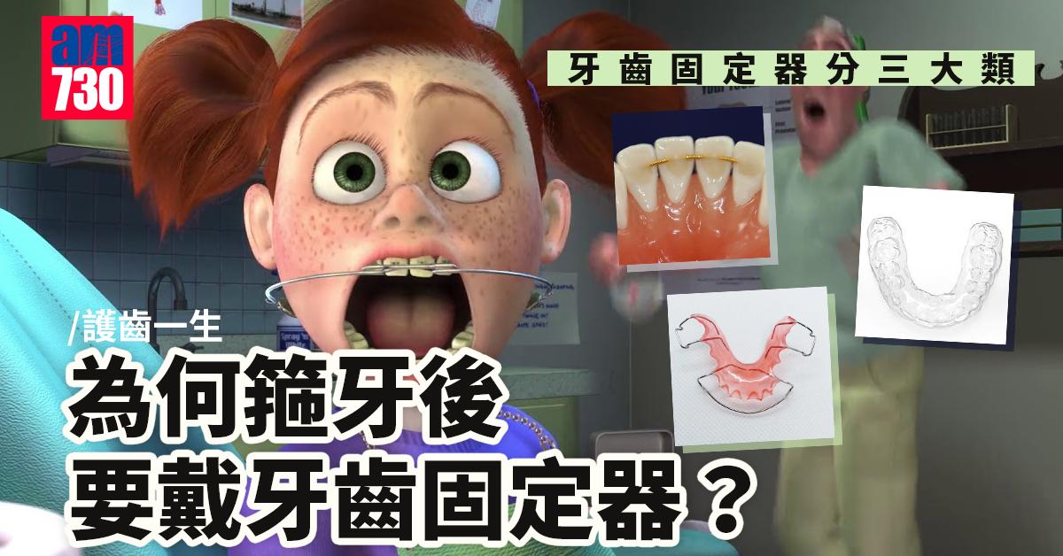 甚麼是牙齒固定器？為何箍牙後要戴牙齒固定器？